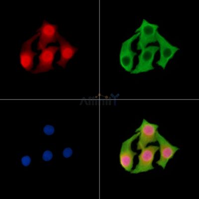 NOS1AP Antibody - DF14807 staining Hela cells by IF/ICC.