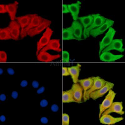 NRARP Antibody - DF14808 staining Hela cells by IF/ICC.