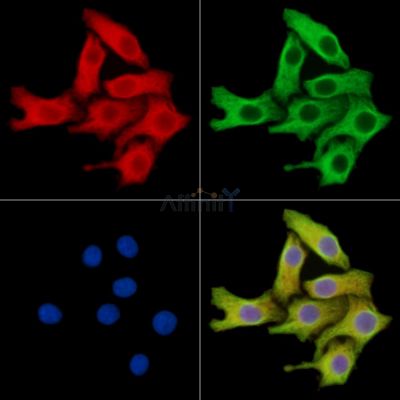 RNASE1 Antibody - DF14814 staining Hela cells by IF/ICC.