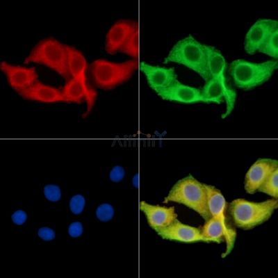 INTS6L Antibody - DF14817 staining Hela cells by IF/ICC.
