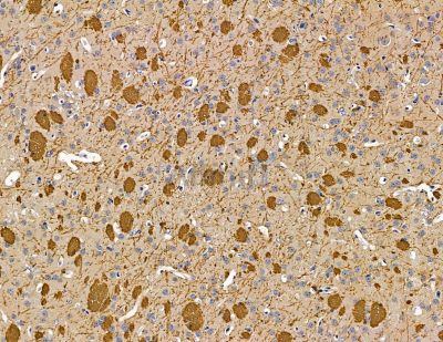 INTS6L Antibody - DF14817 at 1/100 staining mouse brain tissue by IHC-P.