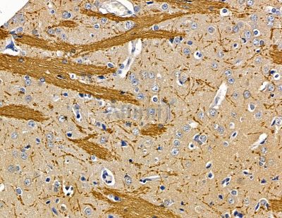 INTS6L Antibody - DF14817 at 1/100 staining rat brain tissue by IHC-P.