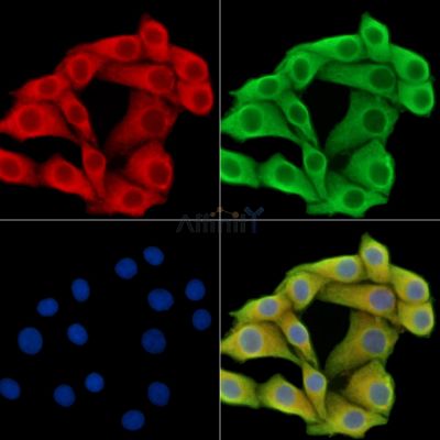 KIF7 Antibody - DF14821 staining Hela cells by IF/ICC.