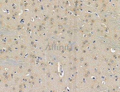 TSPYL1 Antibody - DF14822 at 1/100 staining rat brain tissue by IHC-P.