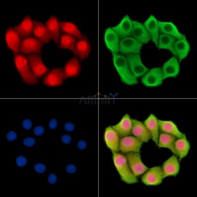GLE1 Antibody - DF14826 staining Hela cells by IF/ICC.