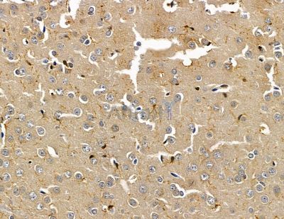 GLE1 Antibody - DF14826 at 1/100 staining rat brain tissue by IHC-P.