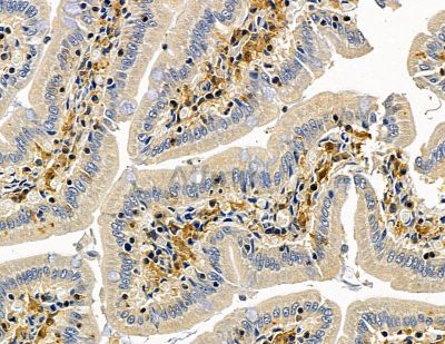 GLE1 Antibody - DF14826 at 1/100 staining rat colorectal tissue by IHC-P.