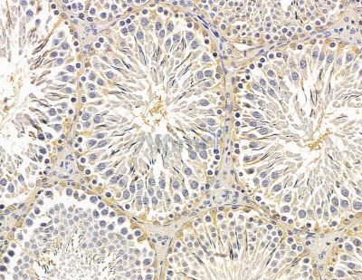 PHEX Antibody - DF14830 at 1/100 staining rat testis tissue by IHC-P.