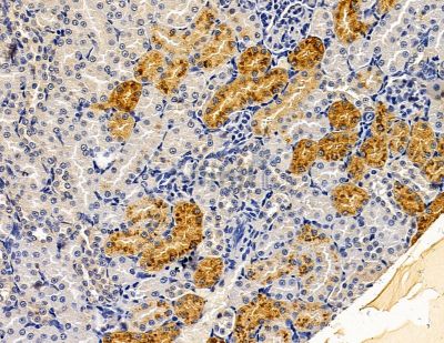 LIMCH1 Antibody - DF14832 at 1/100 staining rat kidney tissue by IHC-P.