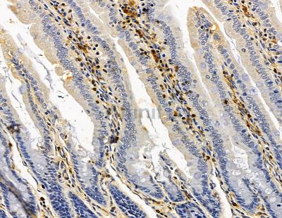 PPFIBP2 Antibody - DF14839 at 1/100 staining rat colorectal tissue by IHC-P.