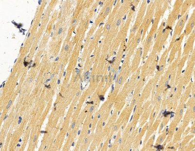 ENTPD6 Antibody - DF14840 at 1/100 staining rat heart tissue by IHC-P.