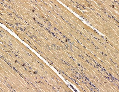SCYL3 Antibody - DF14841 at 1/100 staining rat muscle tissue by IHC-P.