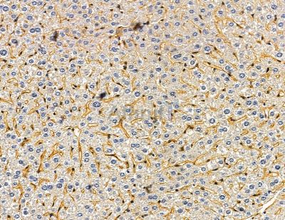 CARHSP1 Antibody - DF14849 at 1/100 staining mouse liver tissue by IHC-P.