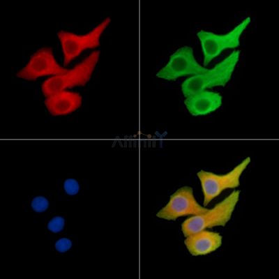 SMR3A Antibody - DF14880 staining Hela cells by IF/ICC.