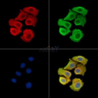 SLC5A8 Antibody - DF14887 staining Hela cells by IF/ICC.