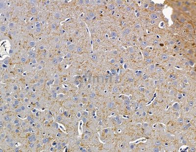 SLC5A8 Antibody - DF14887 at 1/100 staining rat brain tissue by IHC-P.