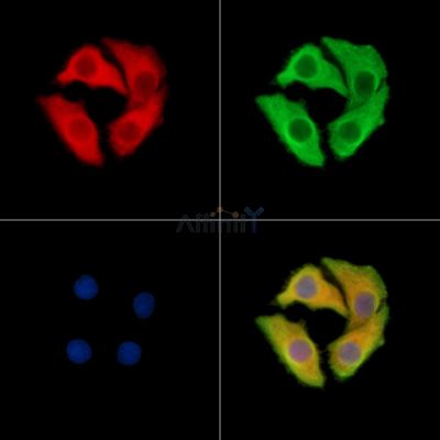 SLC6A5 Antibody - DF14888 staining Hela cells by IF/ICC.