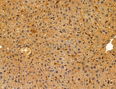 SLC6A5 Antibody - DF14888 at 1/100 staining mouse liver tissue by IHC-P.