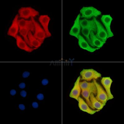 ZC3H12C Antibody - DF14899 staining Hela cells by IF/ICC.