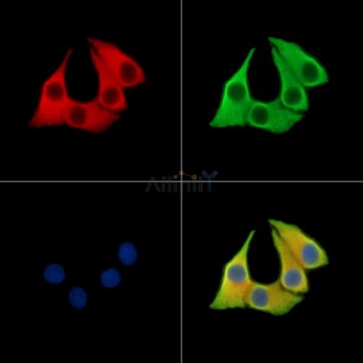 CCDC90B Antibody - DF14900 staining Hela cells by IF/ICC.