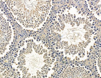 ADAP2 Antibody - DF14904 at 1/100 staining rat testis tissue by IHC-P.