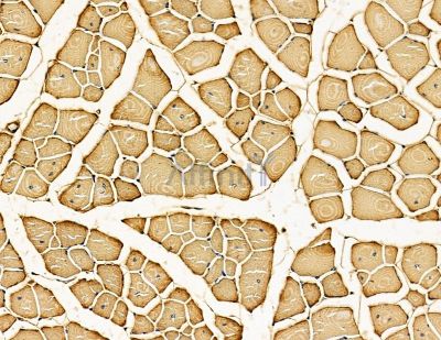 TONSL Antibody - DF14906 at 1/100 staining mouse muscle tissue by IHC-P.