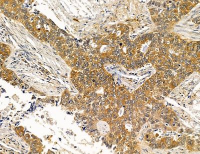 STXBP5 Antibody - DF14908 at 1/100 staining rat pancreatic tissue by IHC-P.