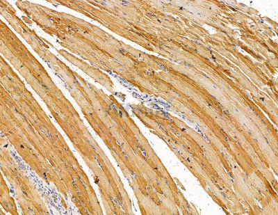 LRRTM1 Antibody - DF14919 at 1/100 staining rat muscle tissue by IHC-P.