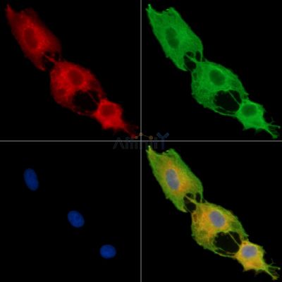 DENND1A Antibody - DF14925 staining A549 cells by IF/ICC.
