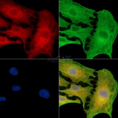SLC14A1 Antibody - DF14926 staining A549 cells by IF/ICC.