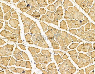 PPP1R18 Antibody - DF14927 at 1/100 staining mouse muscle tissue by IHC-P.