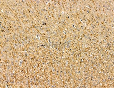 PAAF1 Antibody - DF14934 at 1/100 staining rat brain tissue by IHC-P.