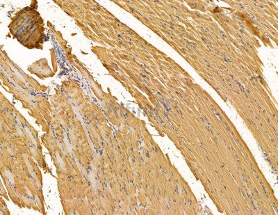 RTP2 Antibody - DF14937 at 1/100 staining rat muscle tissue by IHC-P.