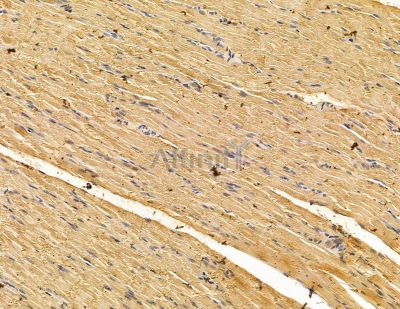 UBXN6 Antibody - DF14938 at 1/100 staining rat muscle tissue by IHC-P.