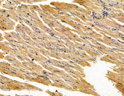 NLRP14 Antibody - DF14959 at 1/100 staining rat muscle tissue by IHC-P.