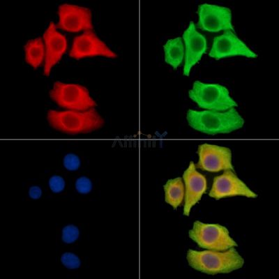 CRISPLD2 Antibody - DF14963 staining Hela cells by IF/ICC.