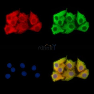 MTFR2 Antibody - DF14965 staining Hela cells by IF/ICC.