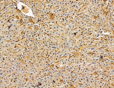 MTFR2 Antibody - DF14965 at 1/100 staining mouse liver tissue by IHC-P.