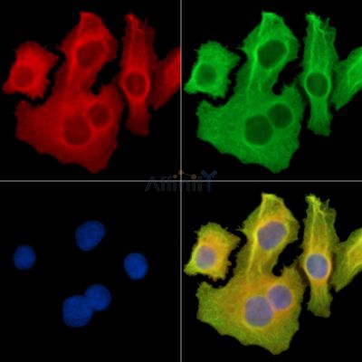 APOBEC3D Antibody - DF14967 staining Hela cells by IF/ICC.