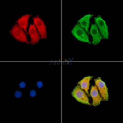 UBE2J2 Antibody - DF14968 staining Hela cells by IF/ICC.