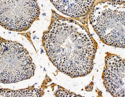 UBE2J2 Antibody - DF14968 at 1/100 staining mouse testis tissue by IHC-P.
