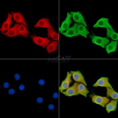 MATN1 Antibody - DF14972 staining Hela cells by IF/ICC.