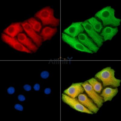 TMEM38B Antibody - DF14974 staining Hela cells by IF/ICC.