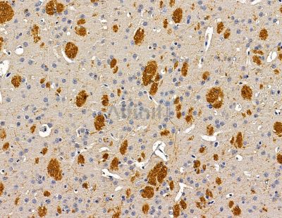 VPS53 Antibody - DF14980 at 1/100 staining mouse brain tissue by IHC-P.
