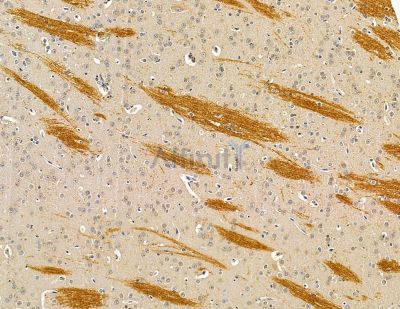 VPS53 Antibody - DF14980 at 1/100 staining rat brain tissue by IHC-P.