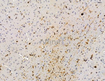 RSRC1 Antibody - DF14990 at 1/100 staining mouse brain tissue by IHC-P.