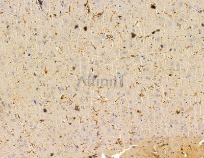 RSRC1 Antibody - DF14990 at 1/100 staining rat brain tissue by IHC-P.