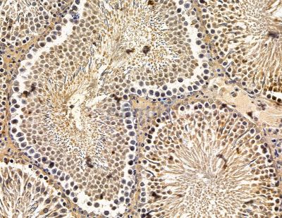 ERCC8 Antibody - DF14993 at 1/100 staining rat testis tissue by IHC-P.