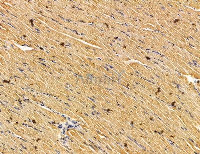 METTL4 Antibody - DF14995 at 1/100 staining mouse ovarian tissue by IHC-P.