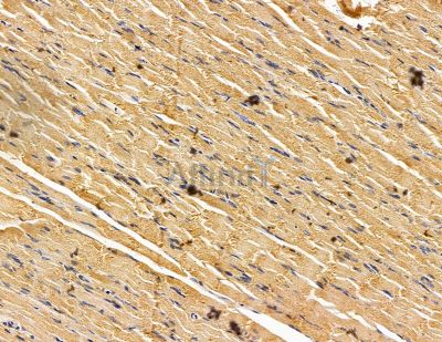 TTC39B Antibody - DF14997 at 1/100 staining rat muscle tissue by IHC-P.